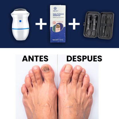 Combo Gel Reparador de Uñas + Eliminador de Callos Eléctrico + Kit Arreglo de Uñas