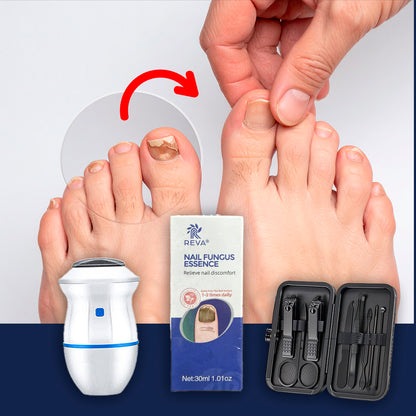 Combo Gel Reparador de Uñas + Eliminador de Callos Eléctrico + Kit Arreglo de Uñas