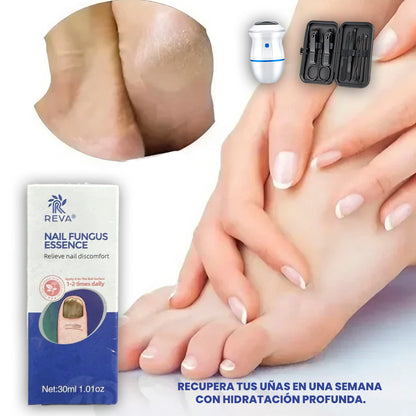 Combo Gel Reparador de Uñas + Eliminador de Callos Eléctrico + Kit Arreglo de Uñas