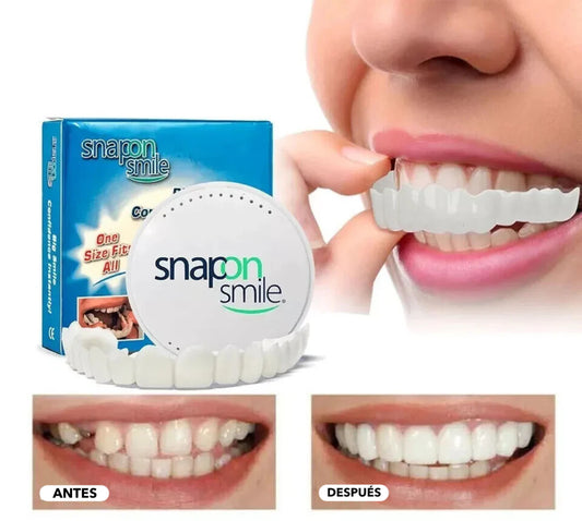 carillas dentales